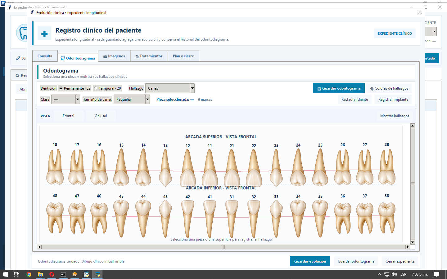 Odontograma de OliDent Pro